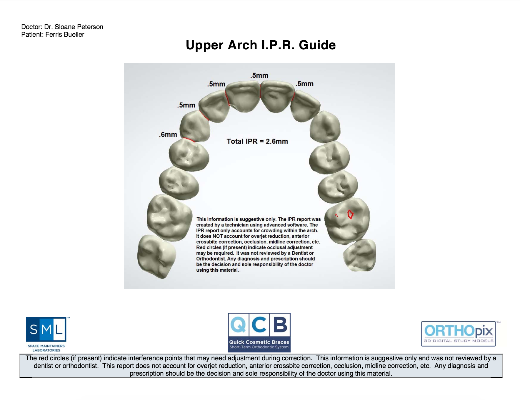 QCB™ IPR Analysis and Digital Models SML
